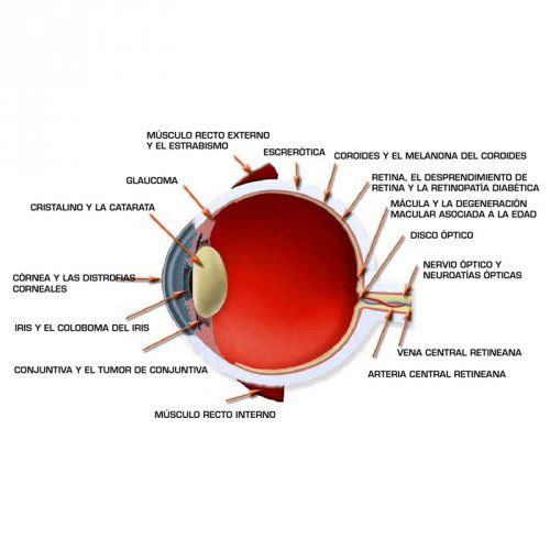 El IRIS y el COLOBOMA del IRIS El IRIS y el COLOBOMA del IRIS